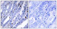 PKA IIβ reg Polyclonal Antibody