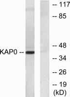 PKA Iα reg Polyclonal Antibody