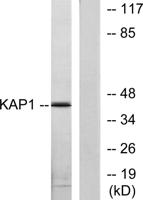 PKA Iβ reg Polyclonal Antibody