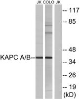 PKAα/β Polyclonal Antibody