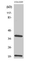 TCR β Polyclonal Antibody