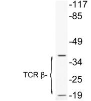 TCR β Polyclonal Antibody