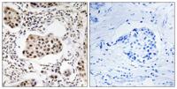 Tctex5 Polyclonal Antibody