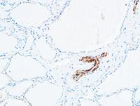 TdT Polyclonal Antibody