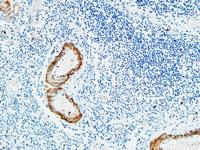 TdT Polyclonal Antibody