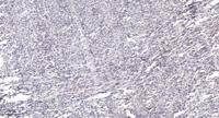 TEF Polyclonal Antibody