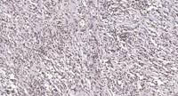 TEF-1 Polyclonal Antibody