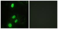 TEL Polyclonal Antibody