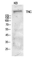 Tenascin-C Polyclonal Antibody