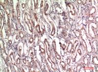 Tenascin-C Polyclonal Antibody