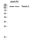 Tensin-2 Polyclonal Antibody