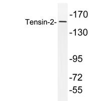 Tensin-2 Polyclonal Antibody