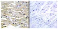 Tensin3 Polyclonal Antibody