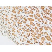 TERT Polyclonal Antibody