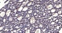 RBAK Polyclonal Antibody