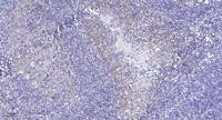 RCL1 Polyclonal Antibody