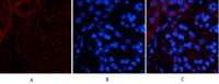 Tak1 Polyclonal Antibody