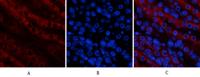 Tak1 Polyclonal Antibody