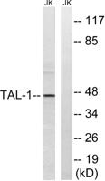 TAL1 Polyclonal Antibody