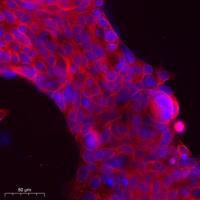 TALK-2 Polyclonal Antibody