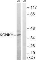 TALK-2 Polyclonal Antibody