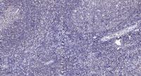 TANK Polyclonal Antibody