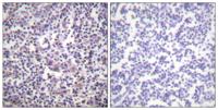 Raf-B Polyclonal Antibody