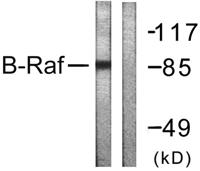 Raf-B Polyclonal Antibody