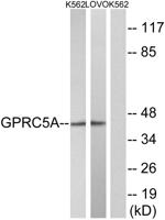 RAI3 Polyclonal Antibody