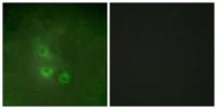 Rak Polyclonal Antibody