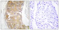 Rak Polyclonal Antibody