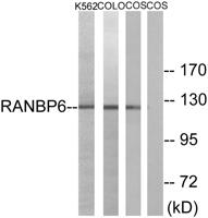 Ran BP-6 Polyclonal Antibody