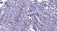 Rap 2C Polyclonal Antibody