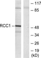 RARβ Polyclonal Antibody