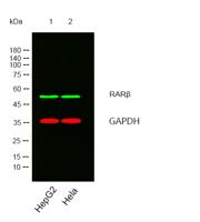 RARβ Polyclonal Antibody