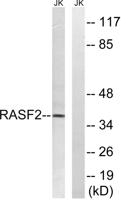 RASSF2 Polyclonal Antibody