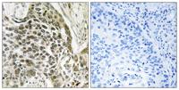 RASSF7 Polyclonal Antibody