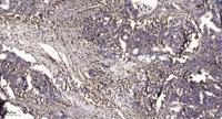 RB3 Polyclonal Antibody