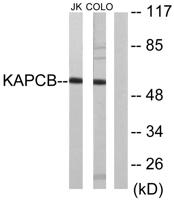 PKAβ Polyclonal Antibody