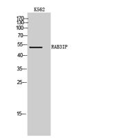 RAB3IP Polyclonal Antibody