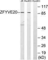 Rabenosyn-5 Polyclonal Antibody