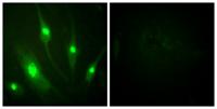 Rac GAP1 Polyclonal Antibody