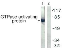 Rac GAP1 Polyclonal Antibody