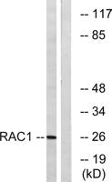 Rac1/2/3/CDC42 Polyclonal Antibody