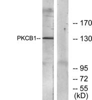 RACK7 Polyclonal Antibody