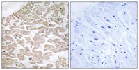 Rad GTPase Polyclonal Antibody