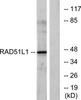 Rad51B Polyclonal Antibody