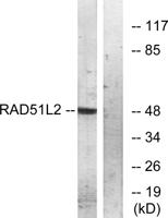 Rad51C Polyclonal Antibody