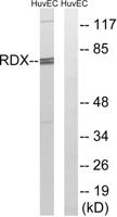 Radixin Polyclonal Antibody