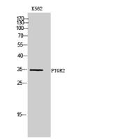 PTGR2 Polyclonal Antibody